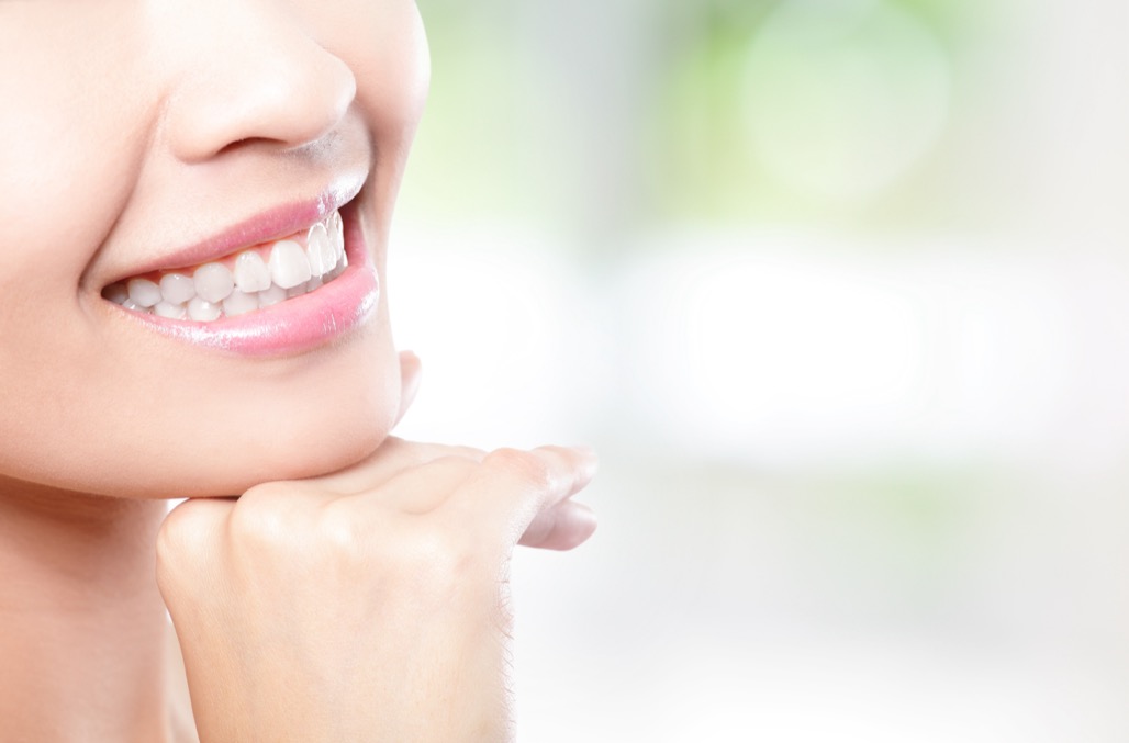 Teeth Whitening Treatment in Litchfield