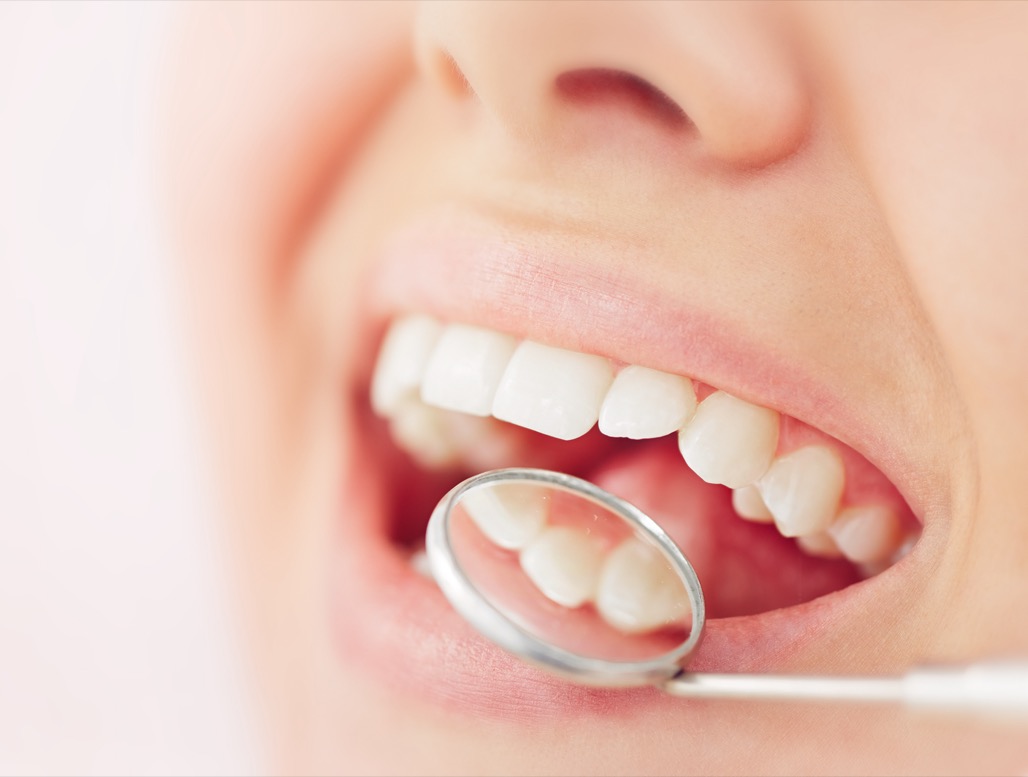 Teeth Cleaning Near Me in Litchfield