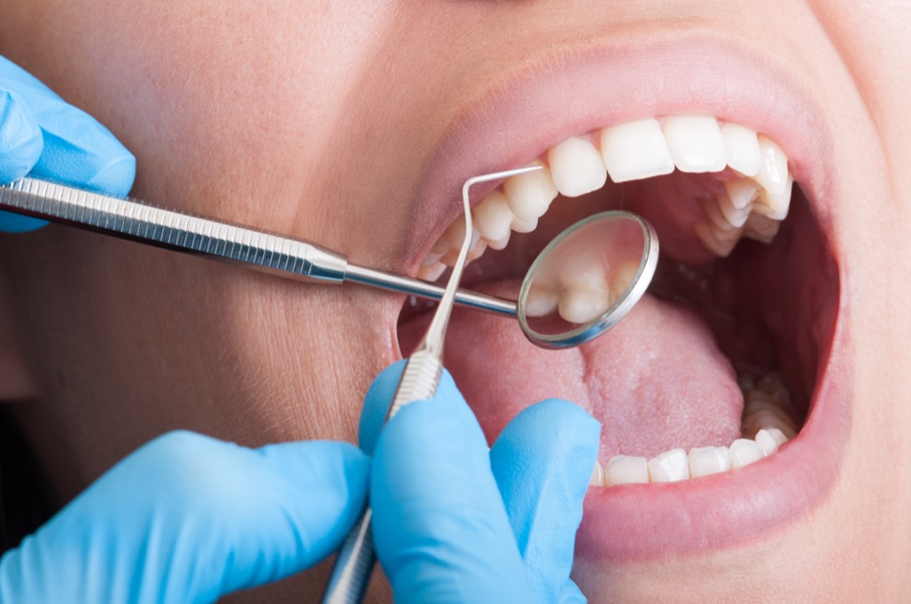 Dental Exam and Cleaning Near Me in Litchfield