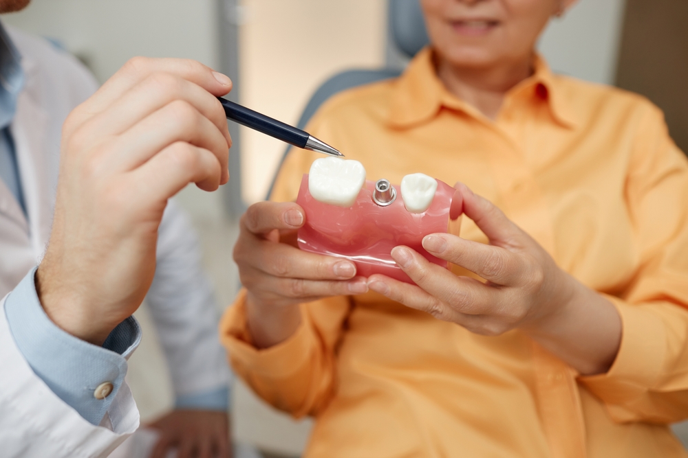 Best Value for Dental Implants – Litchfield