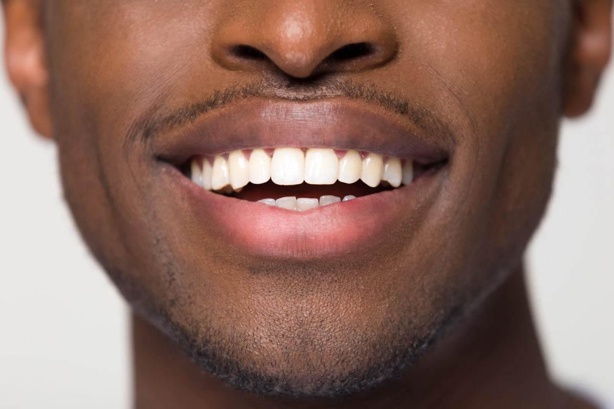 Best Dentist Near Me in Litchfield, MN