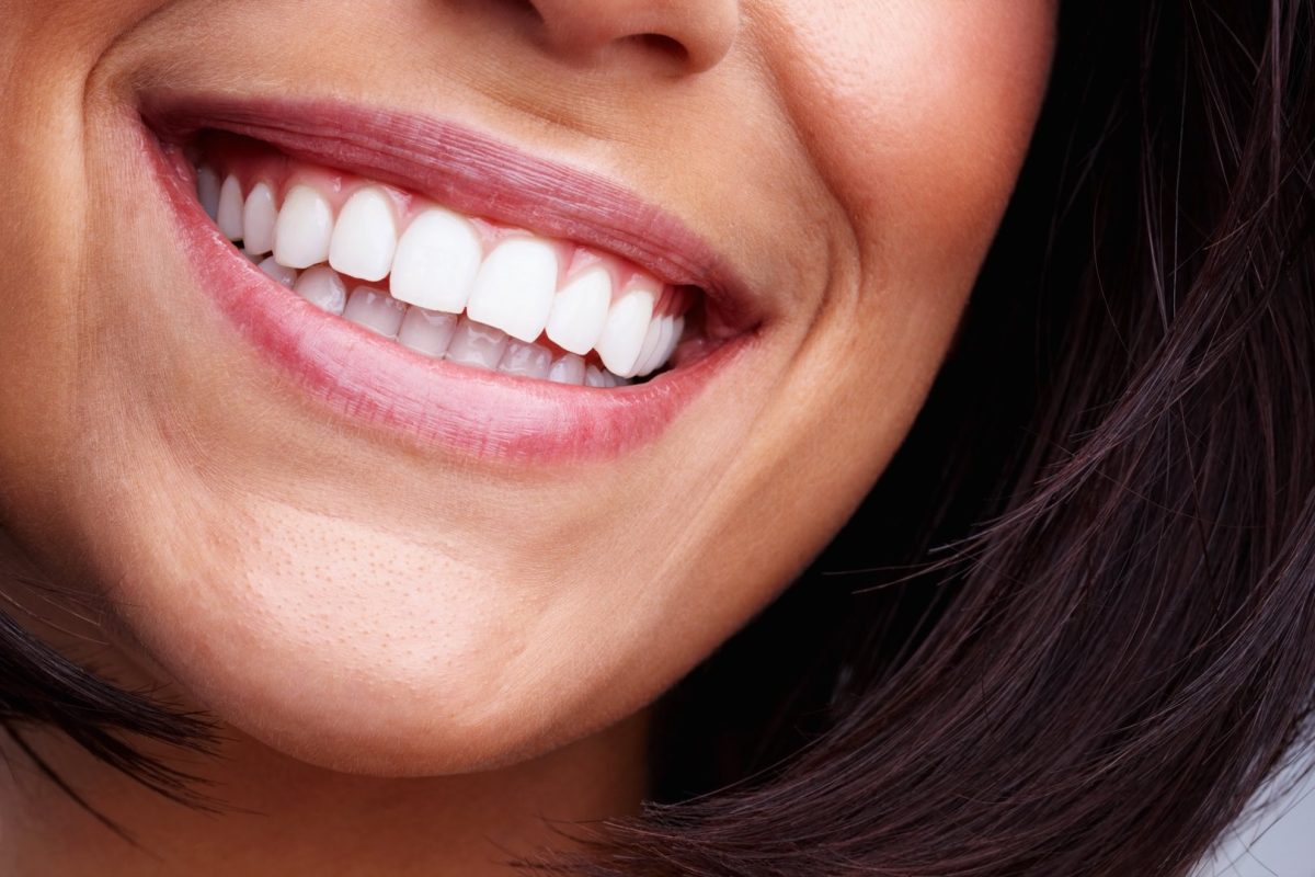 Teeth Cleaning & Exam in Litchfield, MN