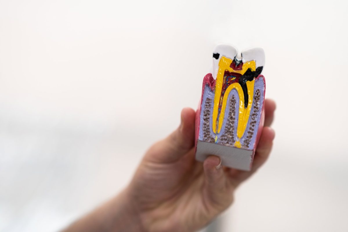 I Think I Have a Cavity, Can I Get Treatment in Litchfield, MN?