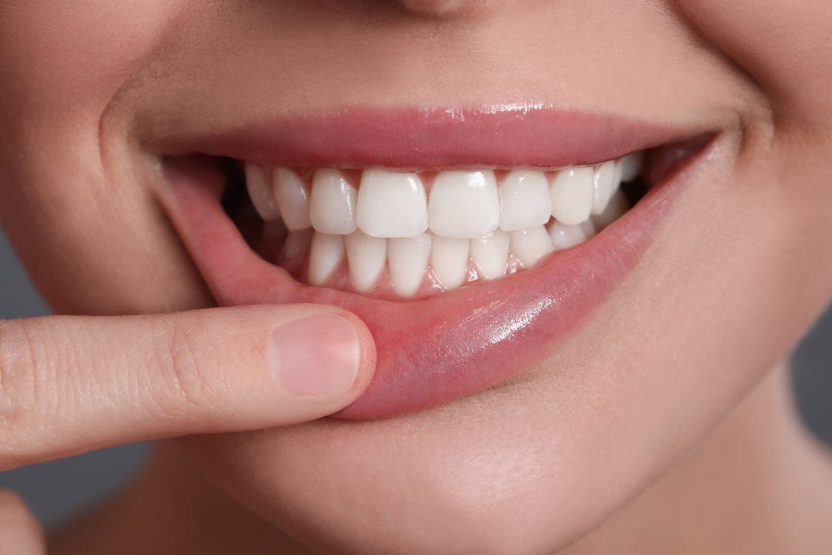 Why Are My Teeth Sensitive? Can a Local Dentist Help in Litchfield, MN?