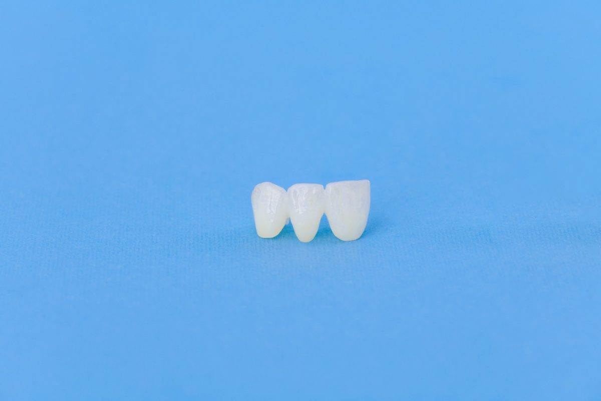Why Are Dental Crowns Important, and Which Dentist Can Treat Me in Litchfield, MN