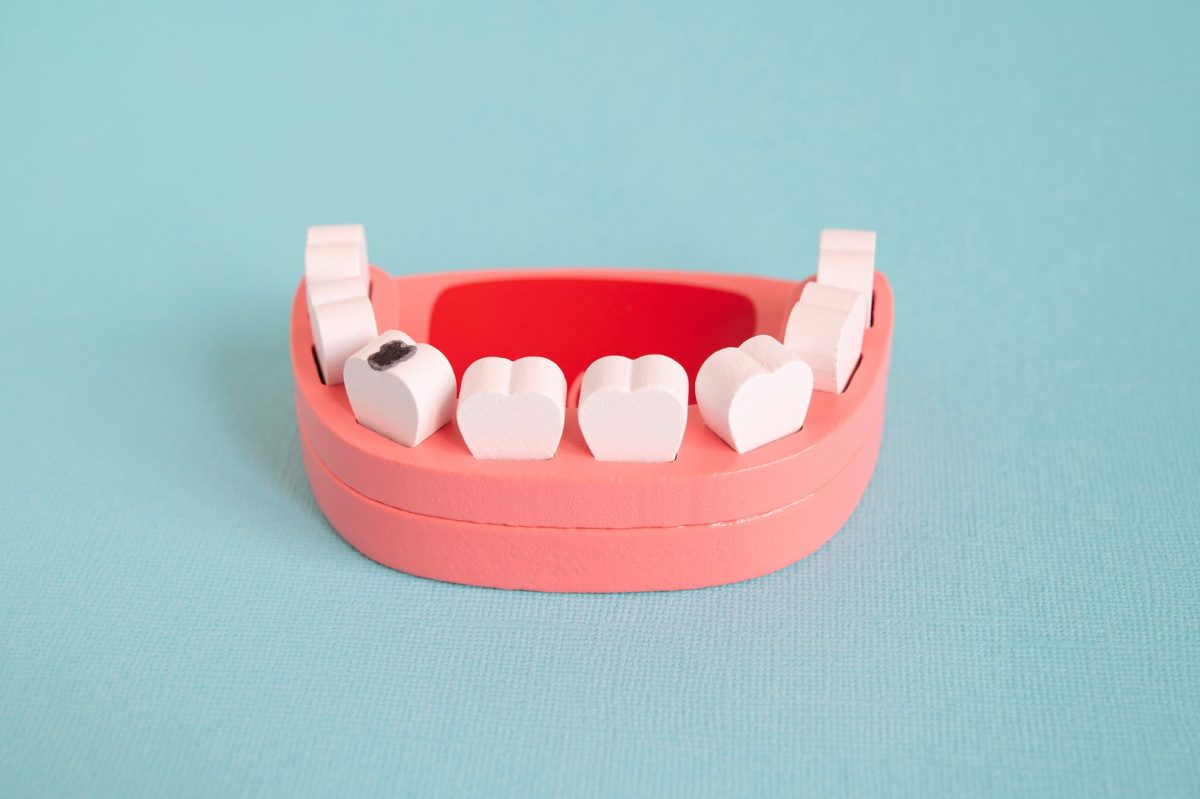 What Are the Signs of Tooth Decay, and Which Dentist Can Help in Litchfield, MN?